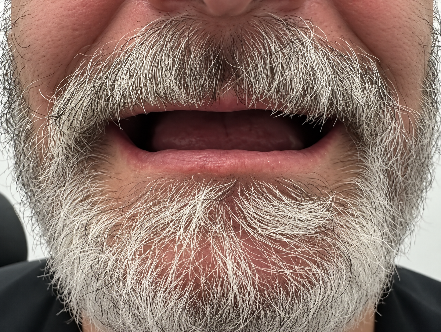 Before — Full smile restoration